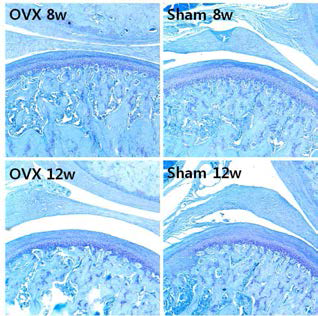 TB staining