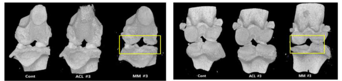 수술 시행 후 2주차 때 희생시킨 랫드의 오른쪽 무릎관절부위 (왼쪽: 앞부분, 오른쪽: 뒷부분)
