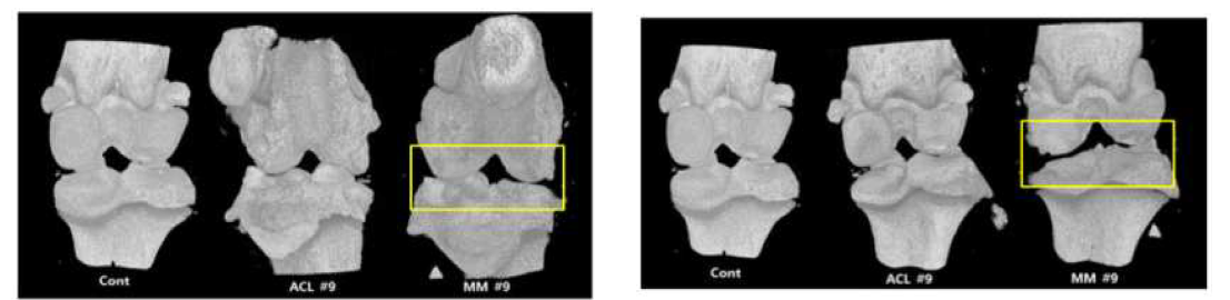 수술 시행 후 4주차 때 희생시킨 랫드의 오른쪽 무릎관절부위 (왼쪽: 앞부분, 오른쪽: 뒷부분)