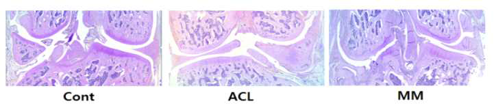 수술하지 않은 control 그룹과 ACL, MM 그룹 조직의 H&E, Toluidine blue, Masson-Trichrome (MT) 염색 (1.25x)