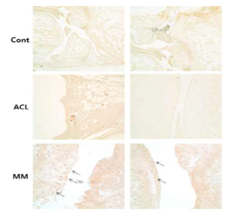 CD8 항체를 사용한 면역조직화학염색 (40x)