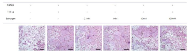 염증물질(TNF-α) 유도 환경에서의 파골세포 분화과정에서의 에스트로겐 효과 분석