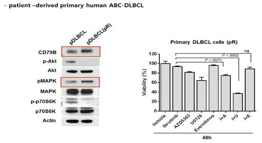 ABC DLBC 환자의 pR 세포에서 BCR 신호전달 기전 확인과 combination 약제 효과 확인