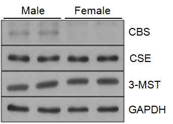 성별 황화수소 생성 관련 단백질의 발현 차이. 수컷 및 암컷 생쥐의 신장을 적출하여 황화수소 생성 단백질인 CBS, CSE 및 3-MST의 발현을 western blot을 이용하여 확인함
