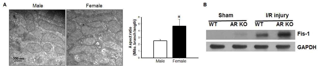 미토콘드리아 수와 dynamics의 성별과 안드로겐수용체 존재유무에 따른 차이. (A) 암컷생쥐의 미토콘드리아 수가 수컷보다 더 많고(TEM 분석), fusion이 더 많음을 알 수 있다. (B) fission과 fusion관련 단백질의 발현이 안드로겐수용체 유무에 따라 다른 양상이다. 전신적 ARKO 생쥐를 30분 허혈 후 24시간 재관류 하였을 때 Fis-1의 발현이 정상에 비해서 더 많았다