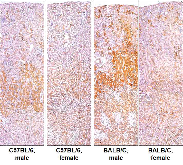 신장에서 안드로겐수용체의 발현 양상. C57BL/6와 BALB/c 생쥐의 신장 절편을 안드로겐 항체를 활용하여 면역염색을 실시하였음