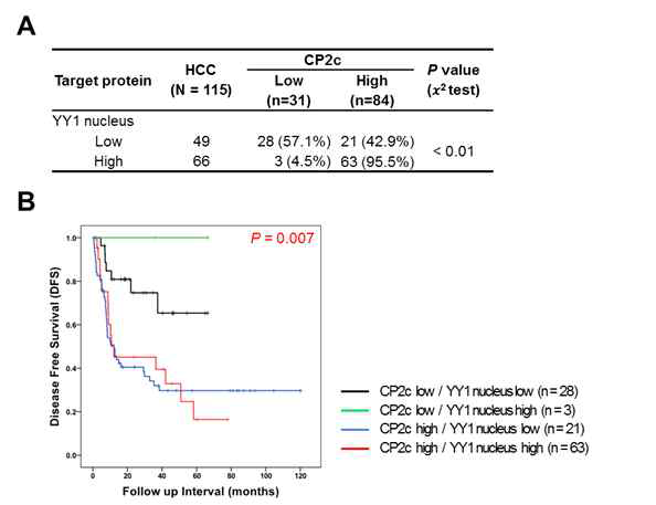 Kaplan-Meier survival curves showing the correlation between marker expression and disease free survival(DFS) or overall survival(OS)