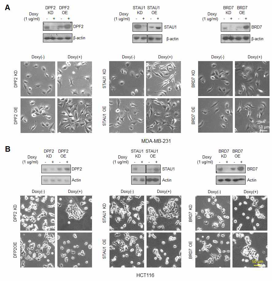 tet-inducible DPF2, STAU1 및 BRD7의 발현번화를 유도할 수 있는 세포주의 확립과 각 세포주의 세포모양 사진