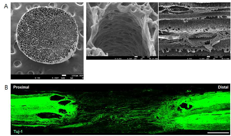 미세관으로 이루어진 내부구조로 된 방향성 스캐폴드의 SEM 사진(A) 및 흰쥐의 완전척수절단모델에 스캐폴드를 이식하고 12주 후에 염색(B 하단)하여 축삭 재생을 확인한 사진