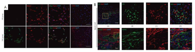 환자유래 치수조직을 초기에 NSC media만으로 배양하여 대조군(A 상단)과는 다르게 Pax6에 염색되는 실험군(A 하단) 사진, (B) 실험군 세포를 흰쥐의 척수좌상모델의 손상부위 내 이식 1주 후 염색 사진