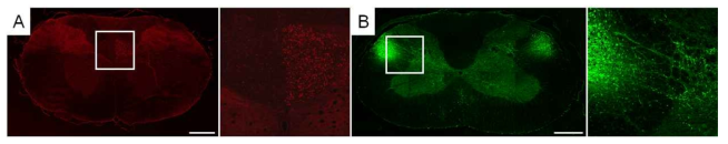 운동피질 내 Fluororuby를 주입하고 2주 뒤 흉수에서 확인한 배부 피질척수로(A, 우측은 확대 사진)와 BDA를 양측 적핵에 주입 후 흉수에서 확인한 양측 적핵척수로(B, 우측은 확대 사진)