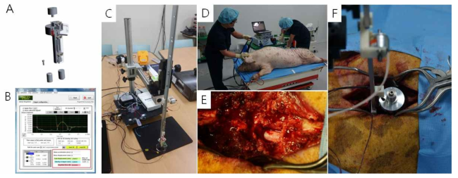 미니피그에 적용하는 척수충격기의 설계도(A), 소프트웨어(B) 및 전체 장치 사진(C). 실제 정상 성인크기의 미니피그(D)의 흉수를 노출한 뒤(E) 척수충격기를 이용하여 척수 손상을 주는 장면(F)