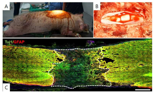 미니피그(65kg, A)의 완전 척수척수철단모델 내 완성된 미세구조 스캐폴드를 이식하는 사진(B) 및 이식12주 후 신경 및 성상세포의 면역형광염색사진(C)
