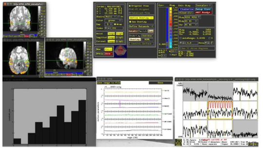 AFNI에서 제공하는 real-time fMRI tool을 이용한 real-time fMRI neurofeedback 환경