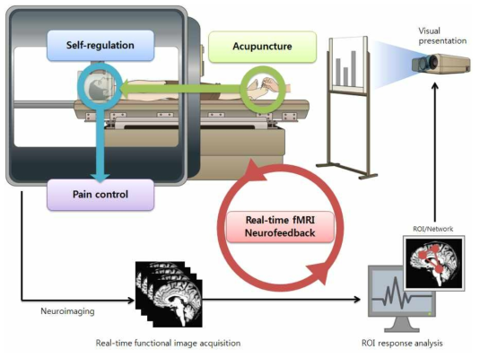 본 연구의 최종 목표의 실현을 위한 시스템 및 실험 구성도 (Real-time neurofeedback 기술, 침 자극, 자가 조절 및 이에 따른 통증조절의 구현)
