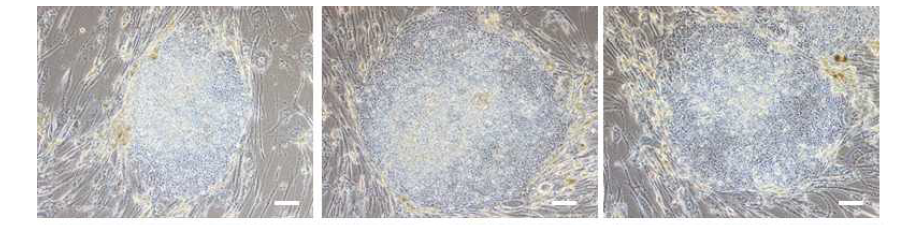 역분화 유도인자를 통해 fibroblast부터 역분화를 유도시킨 후 역분화 줄기세포 colonies로의 형태 변화를 확인함. (Scale bar = 100μm)
