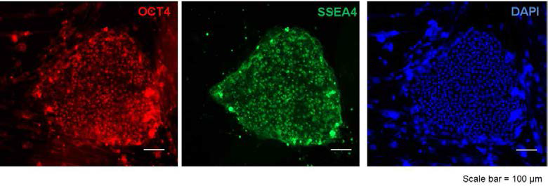 인간 배아줄기세포-특이적인 markers인 Oct-4와 SSEA-4를 이용하여 면역염색을 실시하였으며, Oct-4는 red 으로 SSEA-4는 green 형광의 2차 항체를 붙여서 확 인하였음. (Scale bar = 100μm)