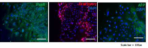 in vitro 3 germ layers 분화 확인을 위한 면역 염색. Ectoderm(PAX6), mesoderm (Brachurury) 및 enderm(AFP) 항체를 이용하여 면역 염색을 하였으며 각 염색 결과는 DAPI와 merge하여 나타내었음. (Scale bar = 100μm)