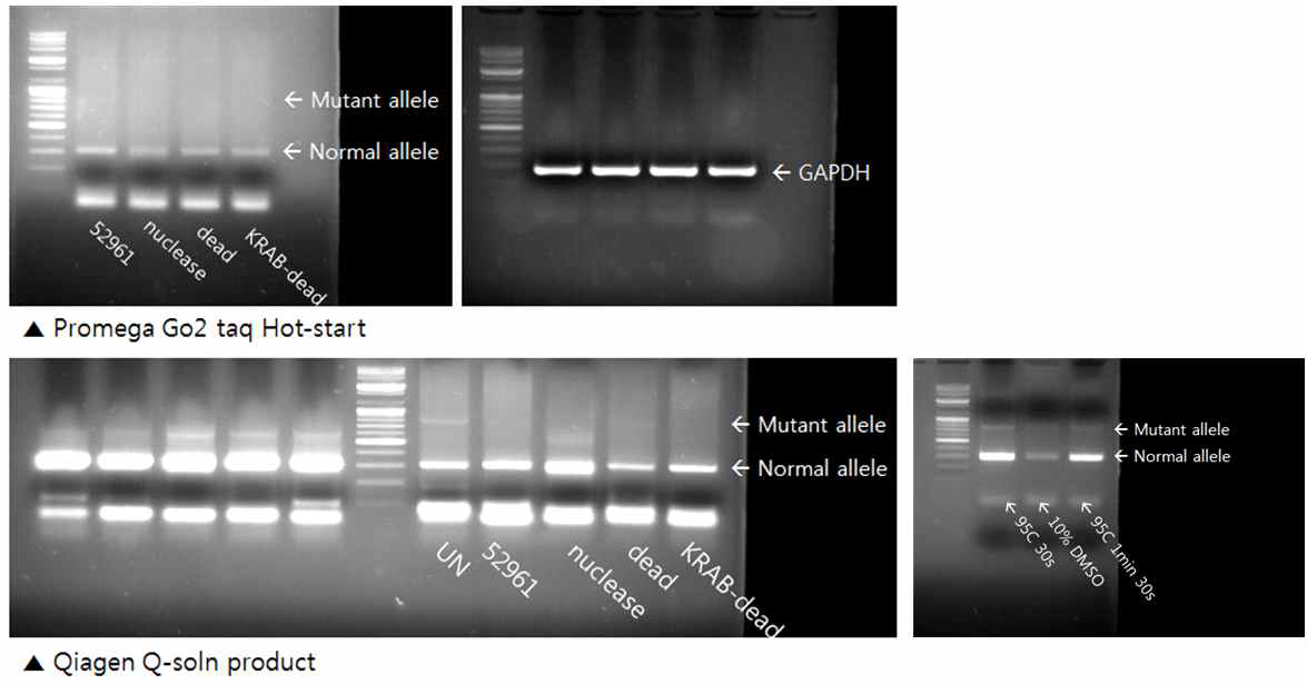 환자 유래 fibroblast에 gRNA3번을 이용한 유전자 가위 (Cas9(Nuclease), dCas9, KRAB-dCas9)를 transduction 한 후 PCR 결과 (Mutant allele (CAG)n = 180 repeat, Normal allele (CAG)n = 18 repeat)