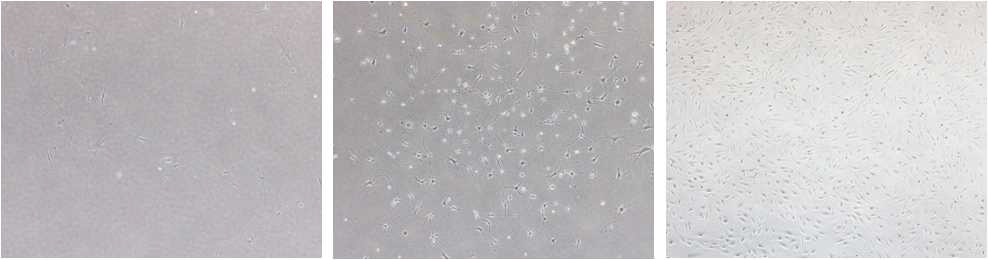 왼쪽부터 지방 유래, 골수 유래 중간엽 줄기세포와 꼬리 유래 섬유아세포를 보여줌