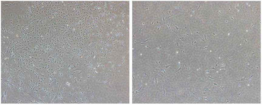 헌팅톤 질병모델에서 골수를 이용하여 중간엽 줄기세포(MSCs)를 확립하였으나 passage 0(왼쪽), passage 1(오른쪽) 으로 증식을 위한 계대배양 시 증식에 한계가 있음을 보여줌