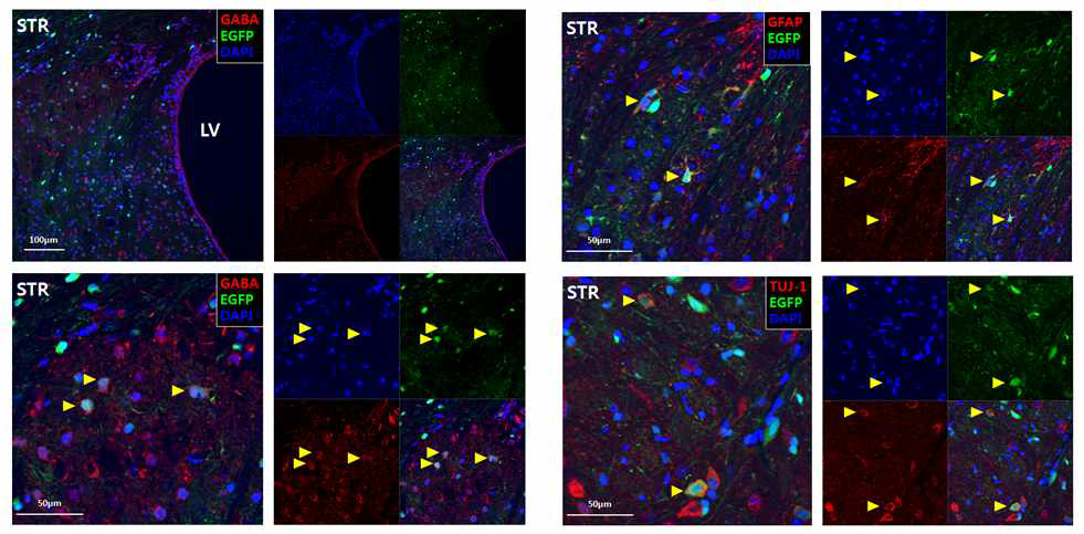 AAV9 리포터인 EGFP 발현이 신경세포(neuron) 및 성상교세포(astrocyte) 에 transduction 됨을 확인함