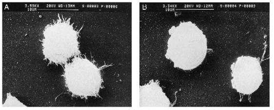 Raji 세포의 전자현미경 사진 : (A)자극을 받지 않은 세포, (B)자극을 받은 세포