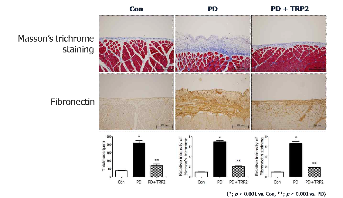 복막 섬유화 동물 모델에서 PTD-BMP-7의 효과 (Masson’s trichrome 결과)