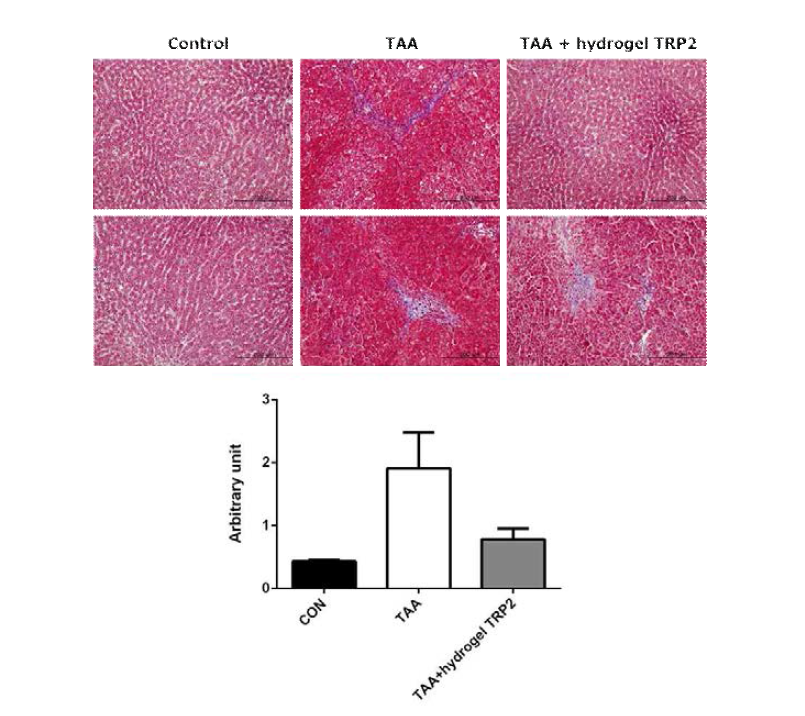 TAA로 유도한 간섬유화 동물 모델에서 hydrogel bound PTD-BMP-7의 주 1회 복강내 투여 효과