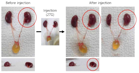 infusion pump를 이용한 hydrogel의 신장내 직접 주입