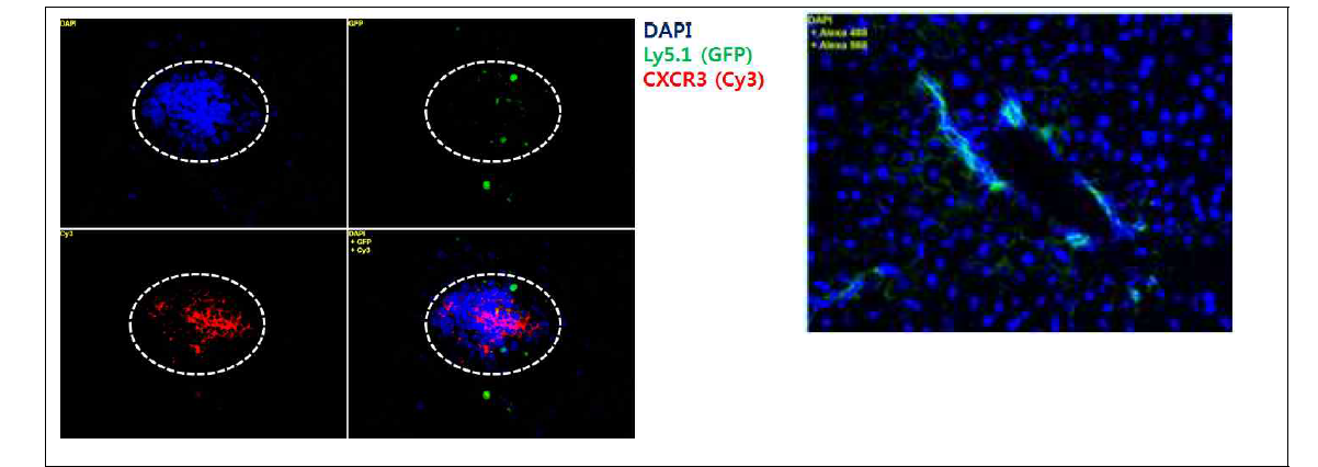 lymphoid aggregates에서 CXCR3와 E-cadherin의 발현