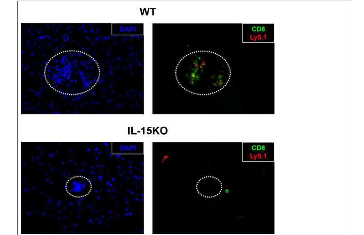 IL-15 결핍 생쥐에서 lymphoid aggregate 축소
