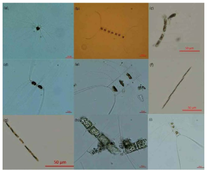 현미경에서 포착된 R1 ~ R5정점과 B1, C1, D1, Z2, Z3정점 표층에서의 우점종. (a) Bacteriatrum delicatulum, (b) Chaetoceros affinis, (c) Chaetoceros atlanticus, (d) Chaetoceros tortissimus, (e) Chaetoceros decipiens, (f) Pseudo-nitzschia pungens, (g) Leptocylindrus minimus, (h) Chaetoceros compressa, (i) Chaetoceros lorenzianus