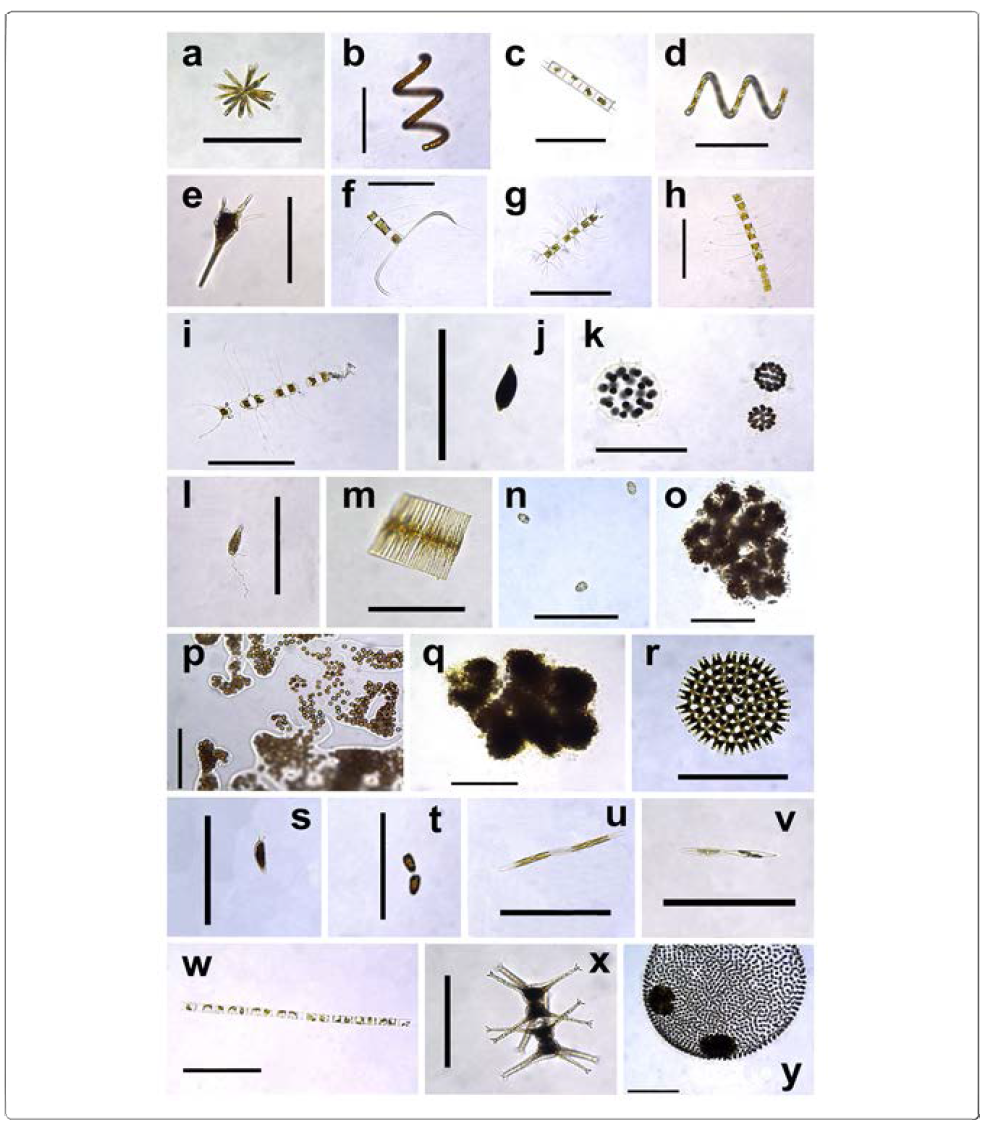 Phytoplankton dominant in the Nakdong River; (a) Actinastrum sp.; (b) Anabaena sp.; (c) Aulacoseira granulate; (d) Aulacoseira ambigua; (e) Ceratium sp.; (f-i) Cheatoceros spp.; (j) Cryptomonas sp.; (k) Eudorina sp.; (l) Euglena sp.; (m) Fragilaria sp.; (n) Heterosigma akashiwo; (o-q) Microcystis spp.; (r) Pediastrum sp.; (s) Prorocentrum gracile; (t) Prorocentrum donghaiense; (u-v) Pseudo-nitzschia sp.; (w) Skeletonema sp.; (x) Staurastrum sp. (y) Volvox sp.; Scale bar = 100 μm