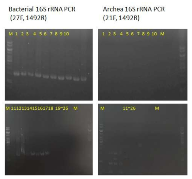 Bacterial or archaeal primers를 이용한 PCR 분석