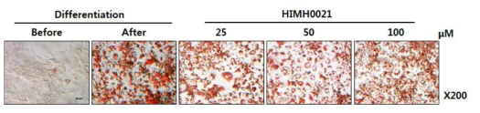 3T3-L1 세포에서 HIMH0021처리에 의한 지방생성 억제효과: Oil Red O
