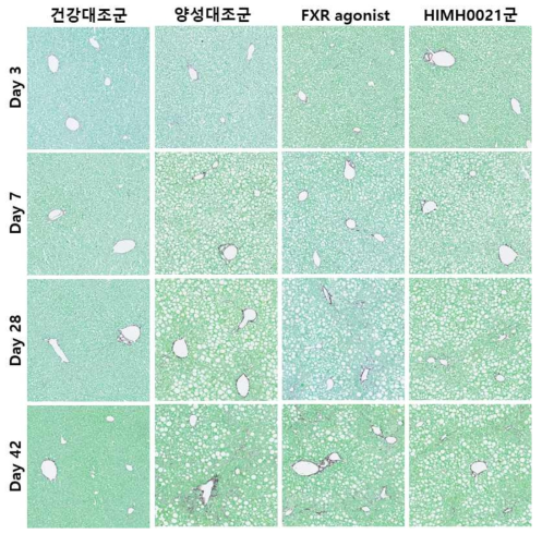 MCD diet로 유도한 비알콜성 지방간 마우스에서 HIMH0021의 간섬유화 억제효능