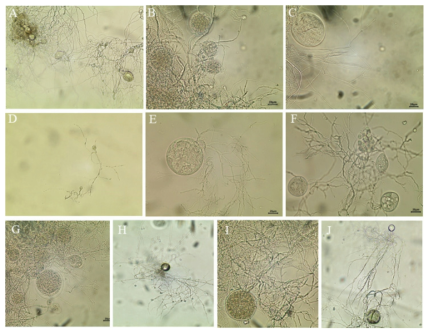 혐기성 균류의 미세구조 A: Pecoramyces sp. J5, B: Neocallimastix sp. J7, C: Pecoramyces sp. J9, D: Pecoramyces sp. J10, E: Neocallimastix sp. J19, F: Neocallimastix sp. J22, G: Neocallimastix sp. J24, H: Neocallimastix sp. J31, I: Neocallimastix sp. J32, J: Neocallimastix sp. J33