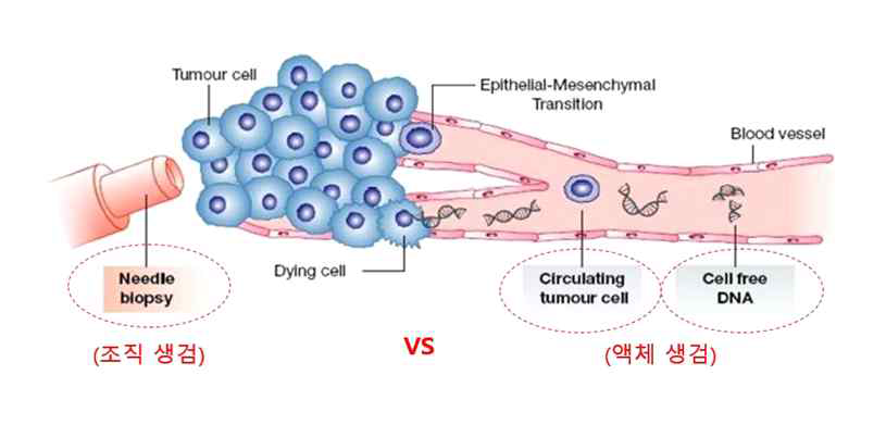 조직생검 vs. 액체생검