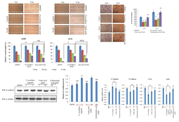 Usnic acid에 의한 암세포 이동/침윤성 억제 및 EMT marker에 대한 영향