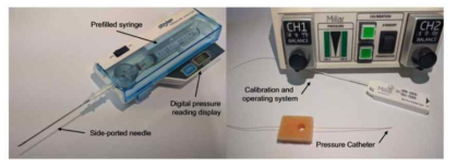 압력 측정은 종양 조직이나 원하는 샘플에 직접 측정 프로브를 삽입하는 방법이 대표적이다. 위크인 니들(WN)과 압력 카테터(PC)법이 직접 압력을 측정하는 대표적 방법이다