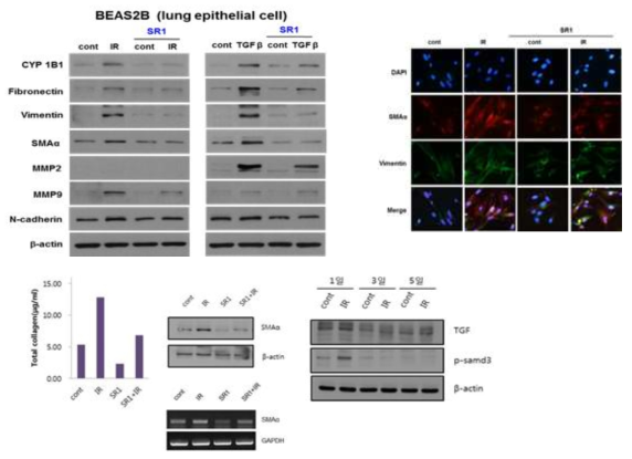 StemRegenin 1 (SR1) 이 폐상피세포와 폐섬유아세포의 섬유화를 억제