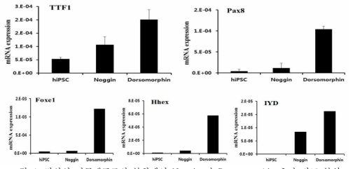 갑상선 전구세포로의 분화에서 Noggin 과 Dorsomorphin 효과 비교 분석