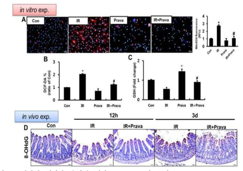 방사선 위장관 손상에 대한 pravastatin의 효과: Anti-oxidative effects in intestinal epithelial cell