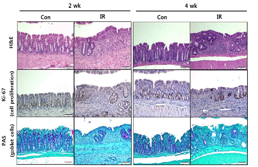 방사선 직장염 모델에서의 조직학적 변화