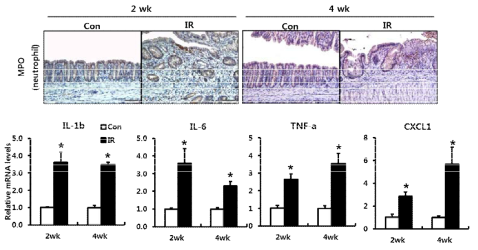 방사선 직장염 모델에서의 염증성 변화