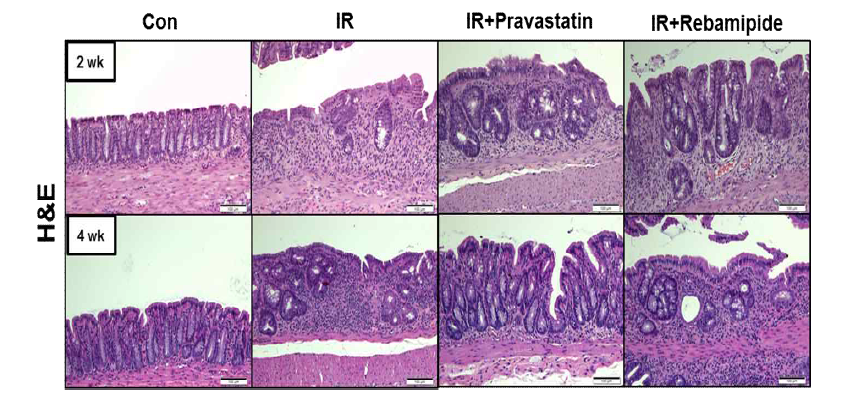 방사선 직장염 모델에서의 pravastatin과 rebamipide의 치료효과