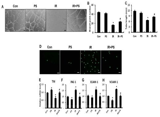 방사선 직장염 모델에서의 pravastatin 치료 효과: HUVECs에서의 방사선에 의한 endothelial dysfunction과 pravastatin에 의한 회복효과