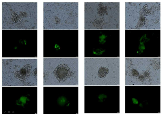 adenovirus with GFP를 transduction한 mouse jejunal organoid