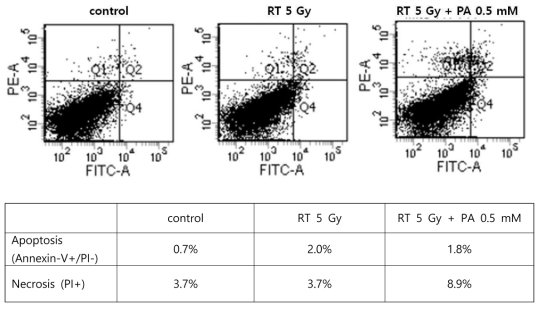 방사선 조사와 지질독성이 NIT-1 cell의 apoptosis / necrosis에 미치는 효과